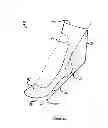 Fig. 02 - SOCK HAVING SECONDARY OPENING