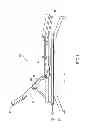 Fig. 02 - VOICE-CONTROLLED VIBRATION ELECTRIC BED