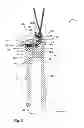 Fig. 06 - Pole handle