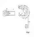 Fig. 02 - Apparatus and Method for Crimping an Implant
