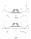 Fig. 04 - Container structure for removal of vacuum pressure