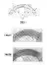 Fig. 02 - Composite material having at least one twisted thread deposited therein
