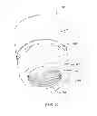 Fig. 06 - Pressure indicating device