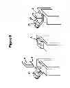 Fig. 07 - Capillary manipulation of clinical samples