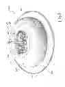 Fig. 02 - Airflow attachment assembly for carburetor