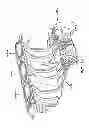 Fig. 14 - Structure to reduce noise and vibration in an engine system