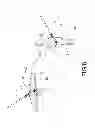 Fig. 07 - Lien's bow