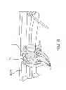 Fig. 07 - Barrel cable suppressor