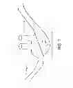 Fig. 09 - Cannula for minimizing dilution of dosing during nitric oxide delivery