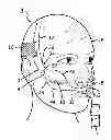 Fig. 01 - HEADGEAR APPARATUS FOR NASAL INTERFACE