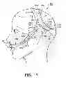Fig. 07 - HEADGEAR APPARATUS FOR NASAL INTERFACE
