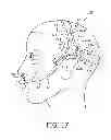Fig. 09 - HEADGEAR APPARATUS FOR NASAL INTERFACE