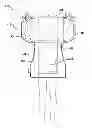 Fig. 01 - RADIOTHERAPY PATIENT IMMOBILIZATION DEVICE AND METHOD