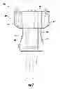 Fig. 07 - RADIOTHERAPY PATIENT IMMOBILIZATION DEVICE AND METHOD