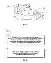 Fig. 06 - MOUTHGUARD FOR THE DELIVERY OF ACTIVE INGREDIENTS