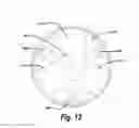 Fig. 14 - SINGLE-TRIP LATERAL CORING SYSTEMS AND METHODS