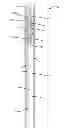 Fig. 01 - Coring bit to whipstock systems and methods