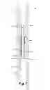 Fig. 08 - Coring bit to whipstock systems and methods
