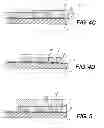 Fig. 04 - Planar cavity MEMS and related structures, methods of manufacture and design structures