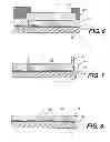 Fig. 05 - Planar cavity MEMS and related structures, methods of manufacture and design structures