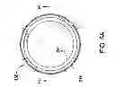Fig. 07 - Adjustable process spacing, centering, and improved gas conductance