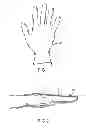 Fig. 02 - Ergonomic surgical glove