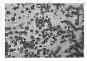 Fig. 01 - Oil emulsification and polycyclic aromatic hydrocarbon adsorption using fine particles as dispersants