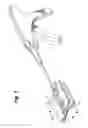 Fig. 02 - Surgical instrument with pressure distribution device