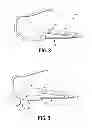Fig. 09 - DISSECTION TIP AND INTRODUCER FOR SURGICAL INSTRUMENT