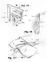 Fig. 06 - Materials delivery system for stapling device