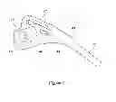 Fig. 07 - PORTABLE MOTORIZED FLUID DELIVERY DEVICE APPARATUS AND METHODS
