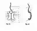 Fig. 02 - Cord Tensioning Device