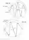 Fig. 20 - Storable intravenous stands