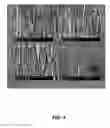 Fig. 05 - PEC ETCHING OF (20-2-1) SEMIPOLAR GALLIUM NITRIDE FOR EXTERNAL EFFICIENCY ENHANCEMENT IN LIGHT EMITTING DIODE APPLICATIONS