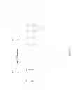 Fig. 04 - High voltage gate formation