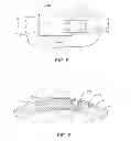 Fig. 04 - Ratcheting anti-rotation lock for threaded connectors