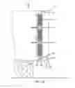 Fig. 07 - Airflow baffle for commercial truck fuel efficiency improvements