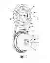 Fig. 03 - Drive device with electric motor and reduction gear
