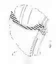 Fig. 09 - VEHICLE RIM PROTECTION DEVICE