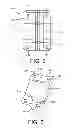 Fig. 03 - Frequency altering brace for an electric motor