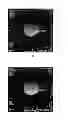 Fig. 03 - Method and apparatus for compensating for gradient delay in magnetic resonance scanning sequence