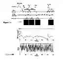 Fig. 11 - Magnetic resonance fingerprinting (MRF) with echo splitting