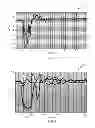 Fig. 04 - Electrostatic discharge protection of amplifier cascode devices