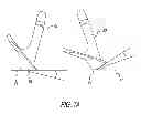 Fig. 17 - VIDEO-GAME CONTROLLER ASSEMBLIES DESIGNED FOR PROGRESSIVE CONTROL OF ACTIONABLE-OBJECTS DISPLAYED ON TOUCHSCREENS: EXPANDING THE METHOD AND BREADTH OF TOUCH-INPUT DELIVERY