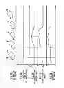 Fig. 17 - Touch-sensitive sheet member, input device and electronic apparatus