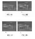 Fig. 05 - Depth dependent filtering of image signal