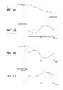 Fig. 04 - Liquid supply device and liquid ejecting apparatus