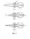 Fig. 02 - System and method for remote measurement of optical focus