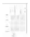 Fig. 02 - Array substrate, manufacturing method for the same and display device