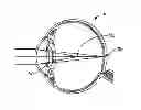 Fig. 01 - Multi-ring lens, systems and methods for extended depth of focus